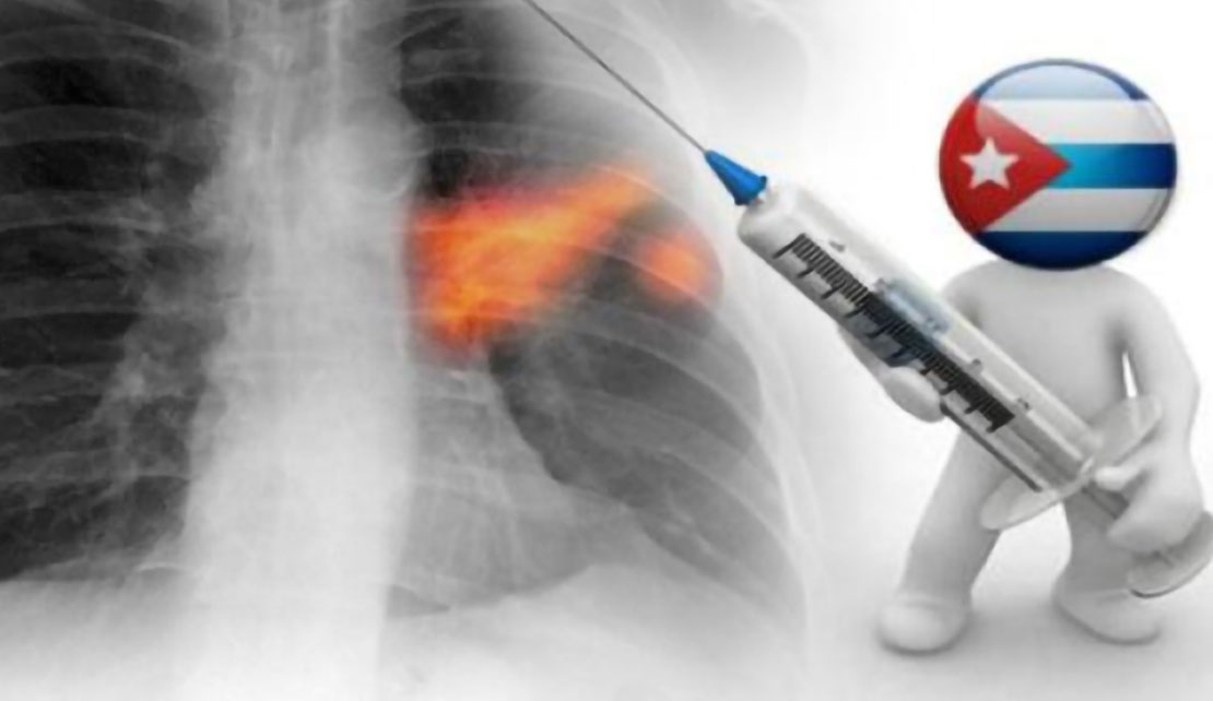 CUBA'S Lung Cancer Vaccine - Cimavax-EGF