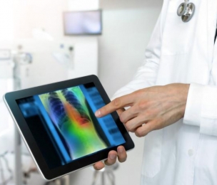 CUBA | Artificial intelligence and radiology in the COVID-19 battle