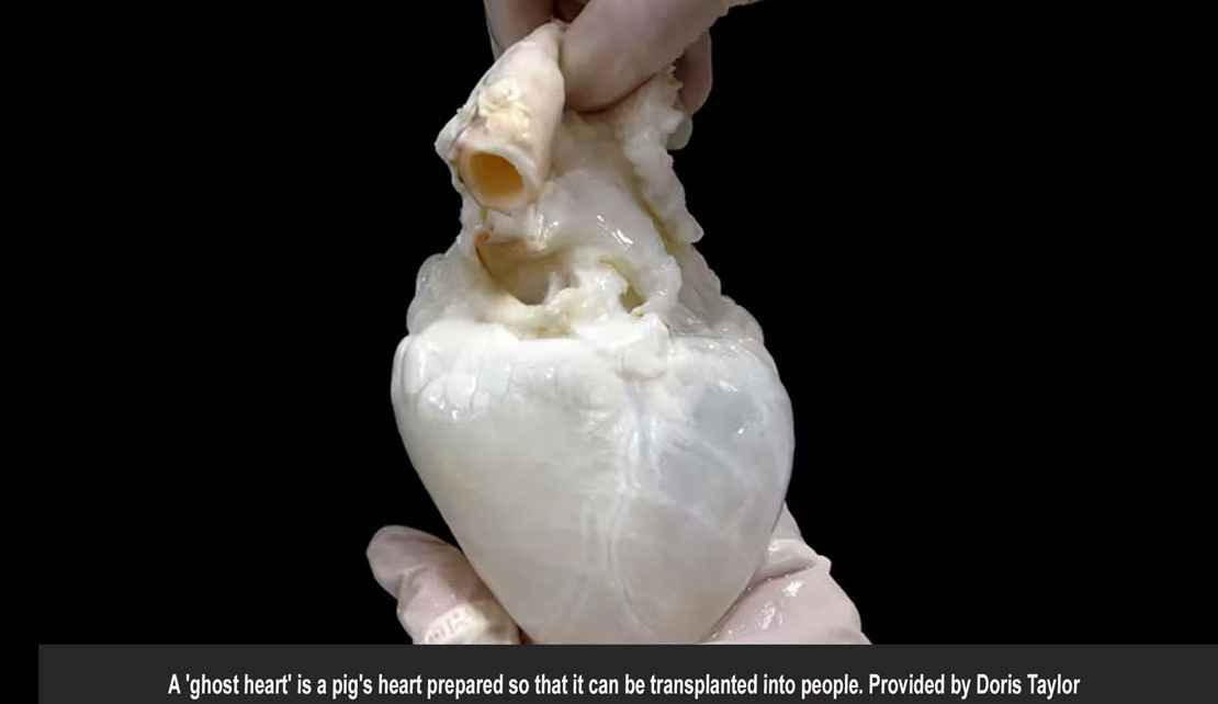 Creating 'ghost hearts'-combining a cleaned-out pig heart with a patient’s own stem cells