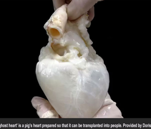 Creating 'ghost hearts'-combining a cleaned-out pig heart with a patient’s own stem cells