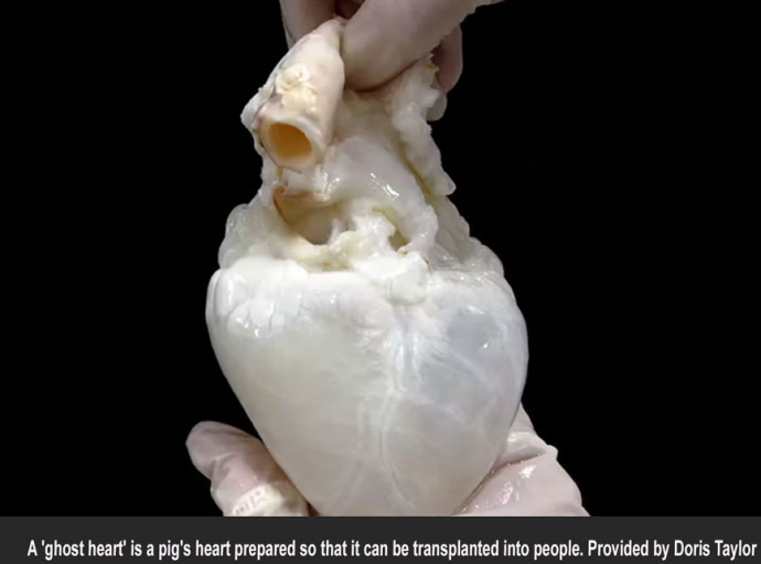 Creating 'ghost hearts'-combining a cleaned-out pig heart with a patient’s own stem cells