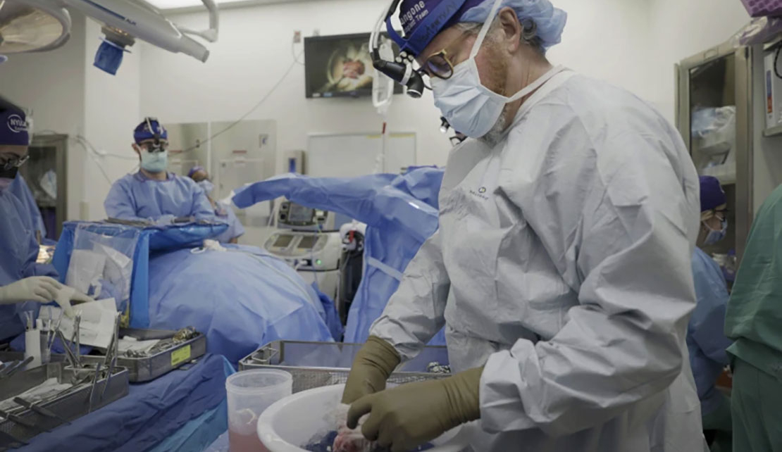 Pig's kidney works in a donated body for over a month, a step toward animal-human transplants