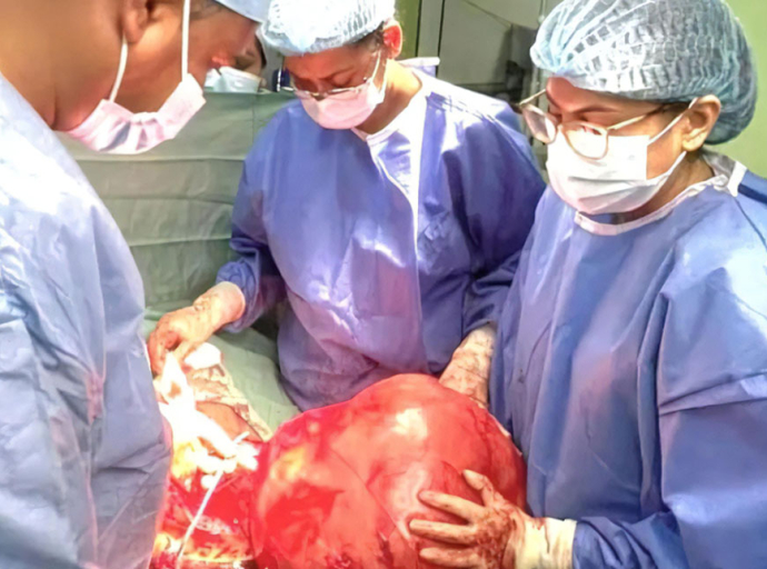 GUYANA | Doctors Remove Massive Intra Abdominal Tumour at Georgetown Public Hospital