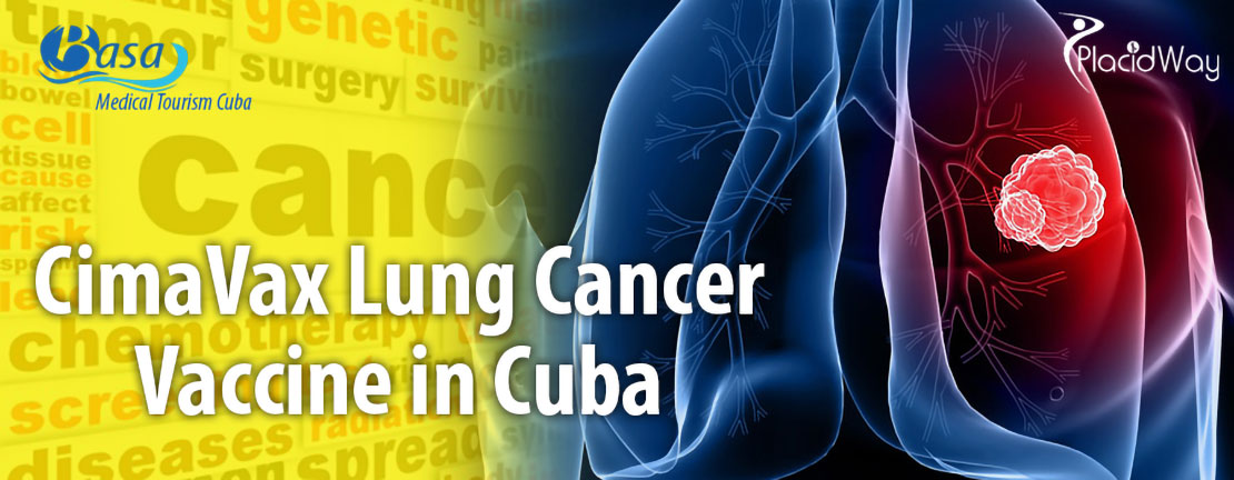 CimaVax Lung Cancer Vaccine Cuba basa travel